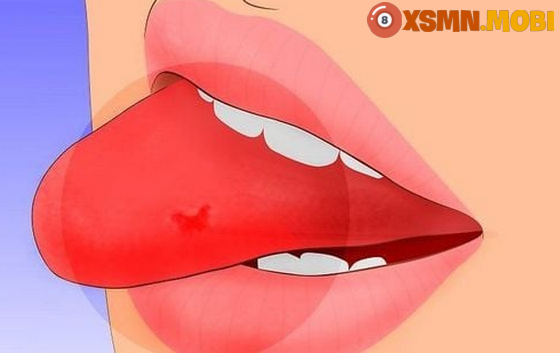 Tự nhiên cắn phải lưỡi có điềm may hay xui? Tự nhiên cắn phải lưỡi có điềm may hay xui?